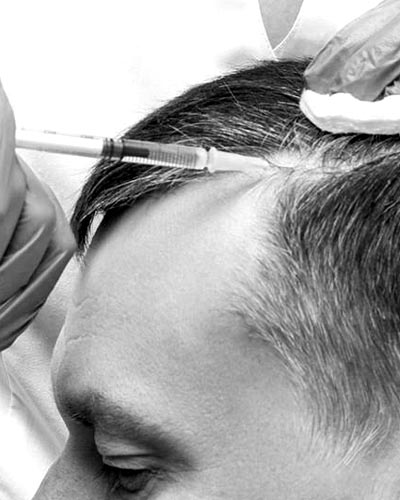 Premier4Him Services Hair Mesotherapy