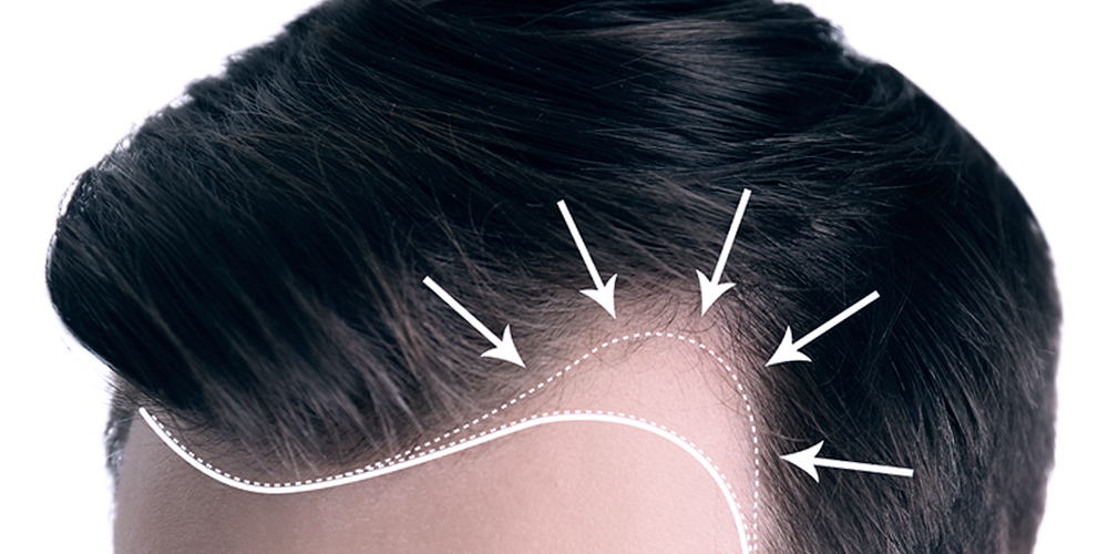 Hair Growth Laser