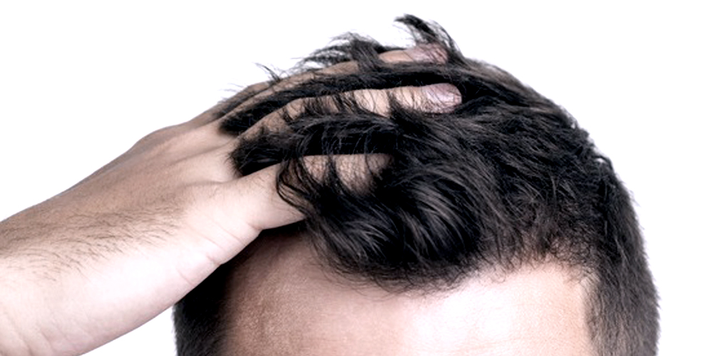 Hair Growth Laser