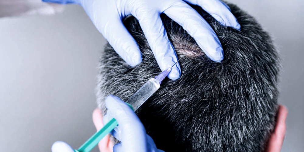 Hair Mesotherapy