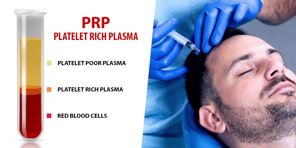 Hair PRP