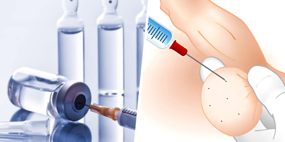 SCROTUM BOTULINUM TOXIN 04 SCROTUM BOTULINUM TOXIN