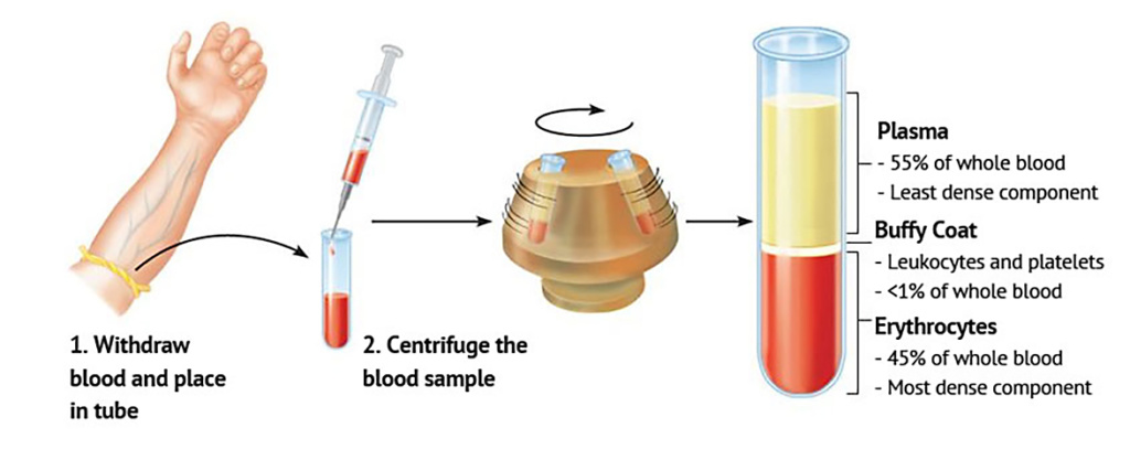 prp treatment malaysia