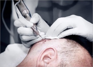 PERSIAPAN KAWASAN PENDERMA (belakang kepala)