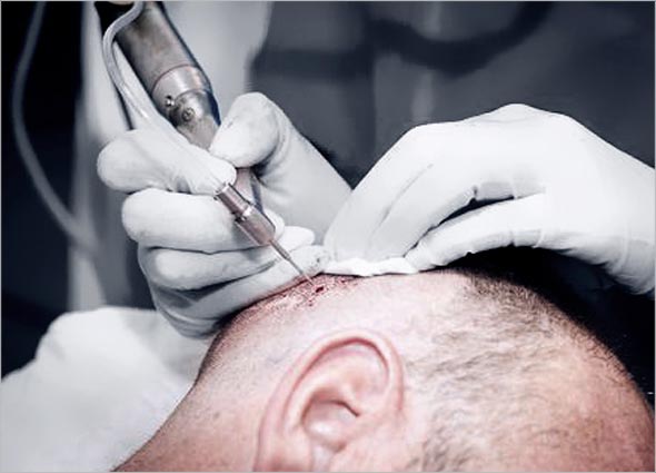 PERSIAPAN KAWASAN PENDERMA (belakang kepala)