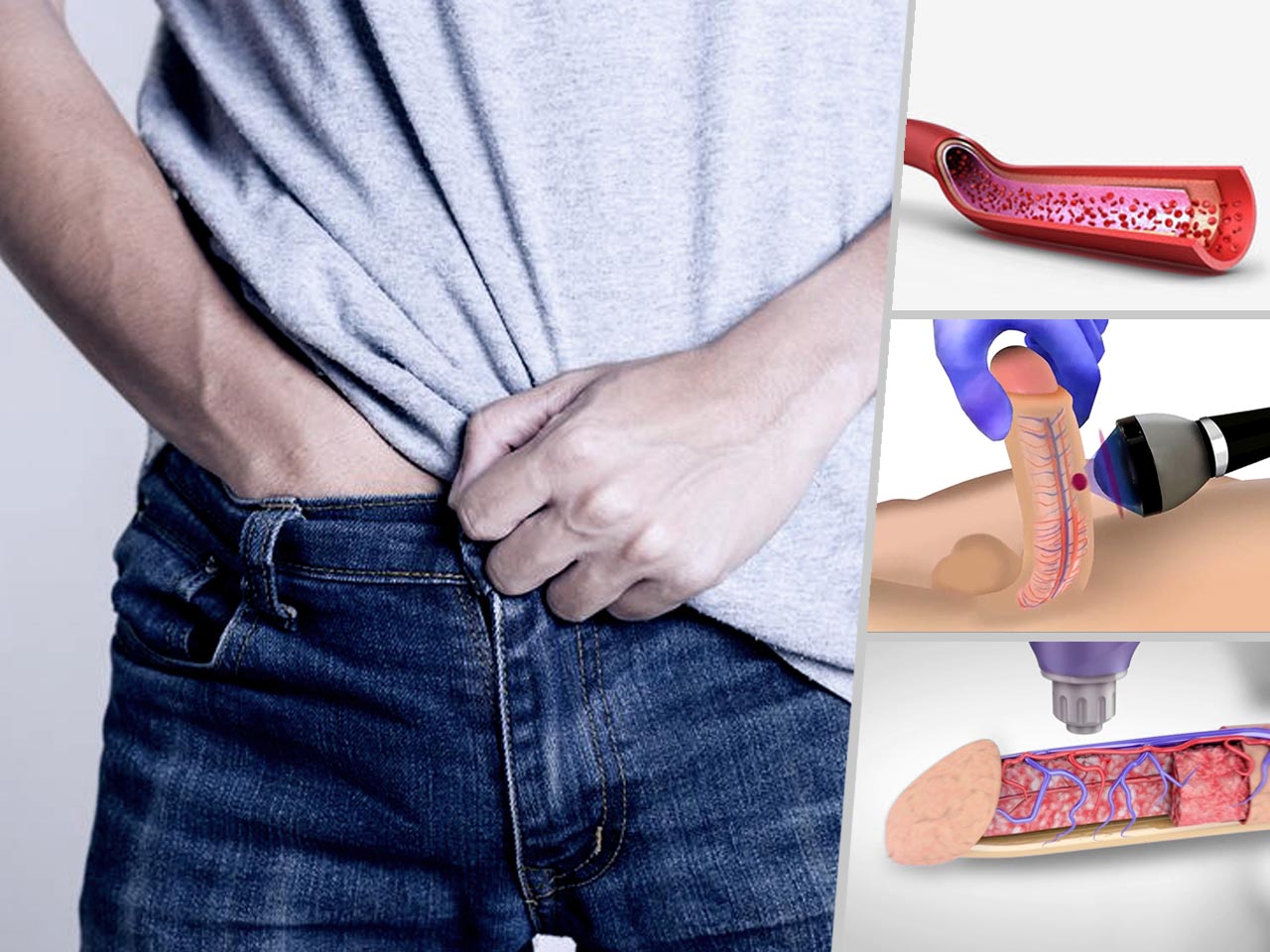 Premier Shockwave therapy