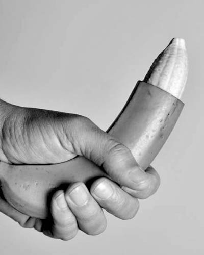 ZSR (Sutureless Circumcision)