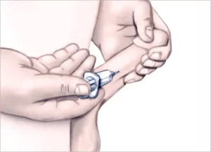 Caverject injection