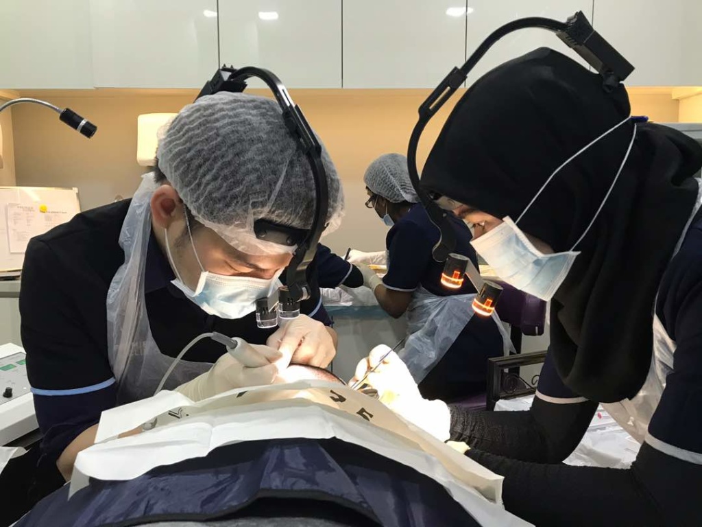 hair transplant by dr foo wing jian