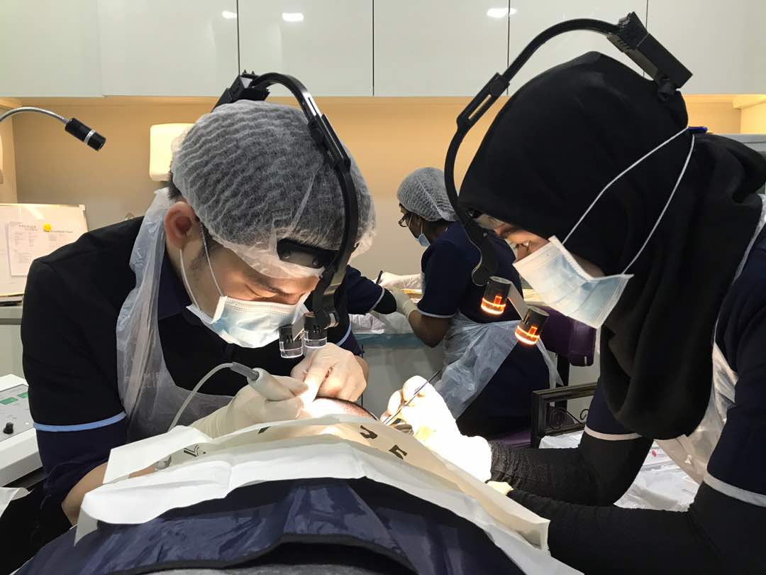 hair transplant by dr foo wing jian