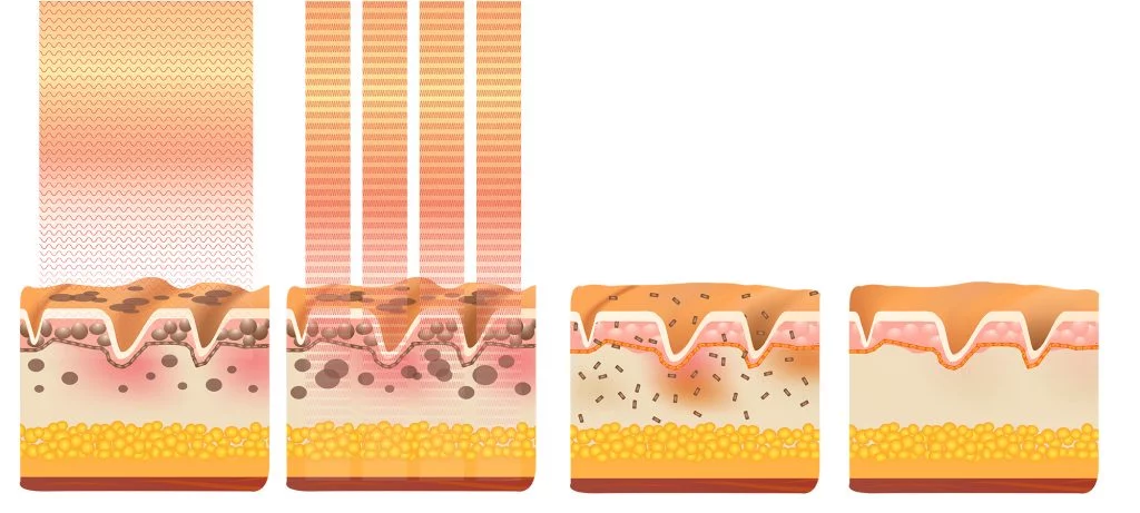 Advanced Skin Whitening 