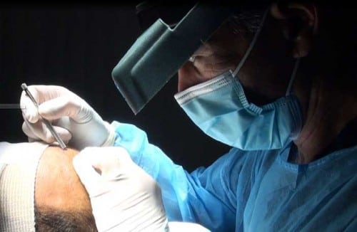 hair transplant treatment
