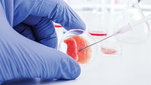 stem cell procedure for ED