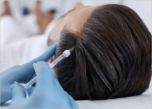 hair loss treatment malaysia 