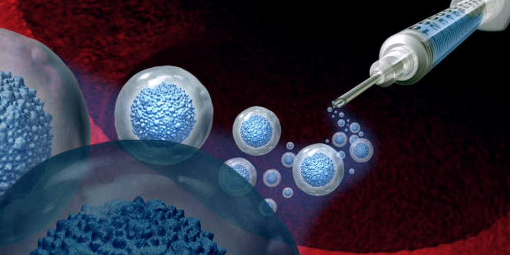 Exosome Therapy