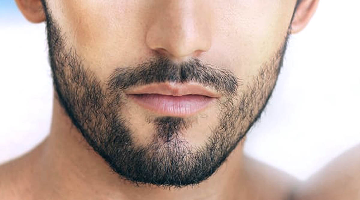 FUE BEARD TRANSPLANT 