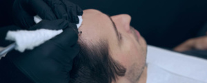 Hair Follicles Enhancer (Scalp Micropigmentation) 