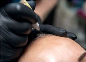 Hair Follicles Enhancer (Scalp Micropigmentation) 