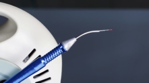 LASER CIRCUMCISION
