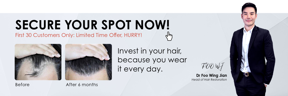 RM4/HAIR FUE HAIR TRANSPLANT PROMO