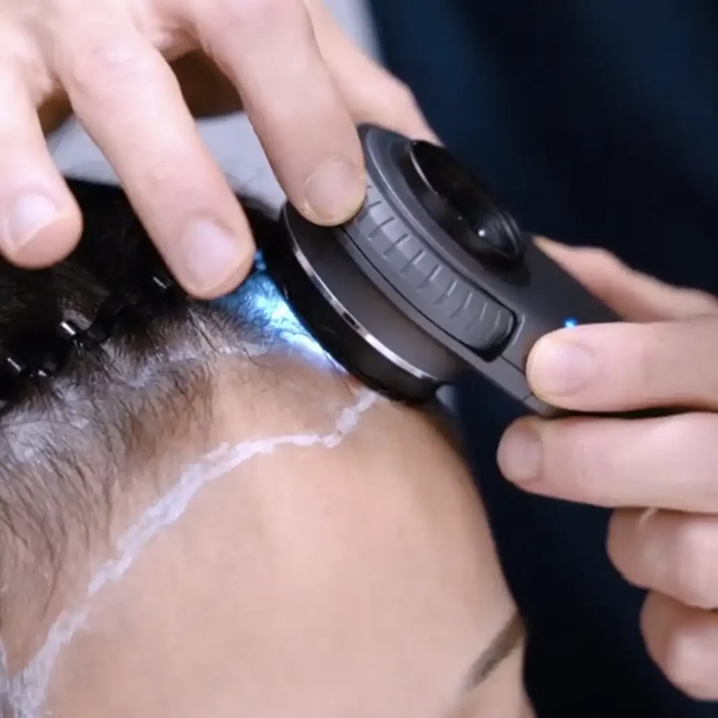 FUE hair transplant expert by Dr Foo