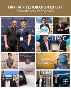 Award-Winning Clinic: Best Hair Transplant Centre in Asia
