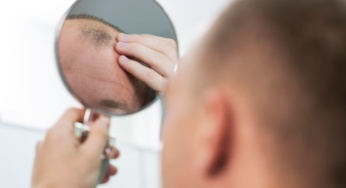 Penyebab Kehilangan Rambut Lelaki: 5 Faktor Penting yang Perlu Diketahui