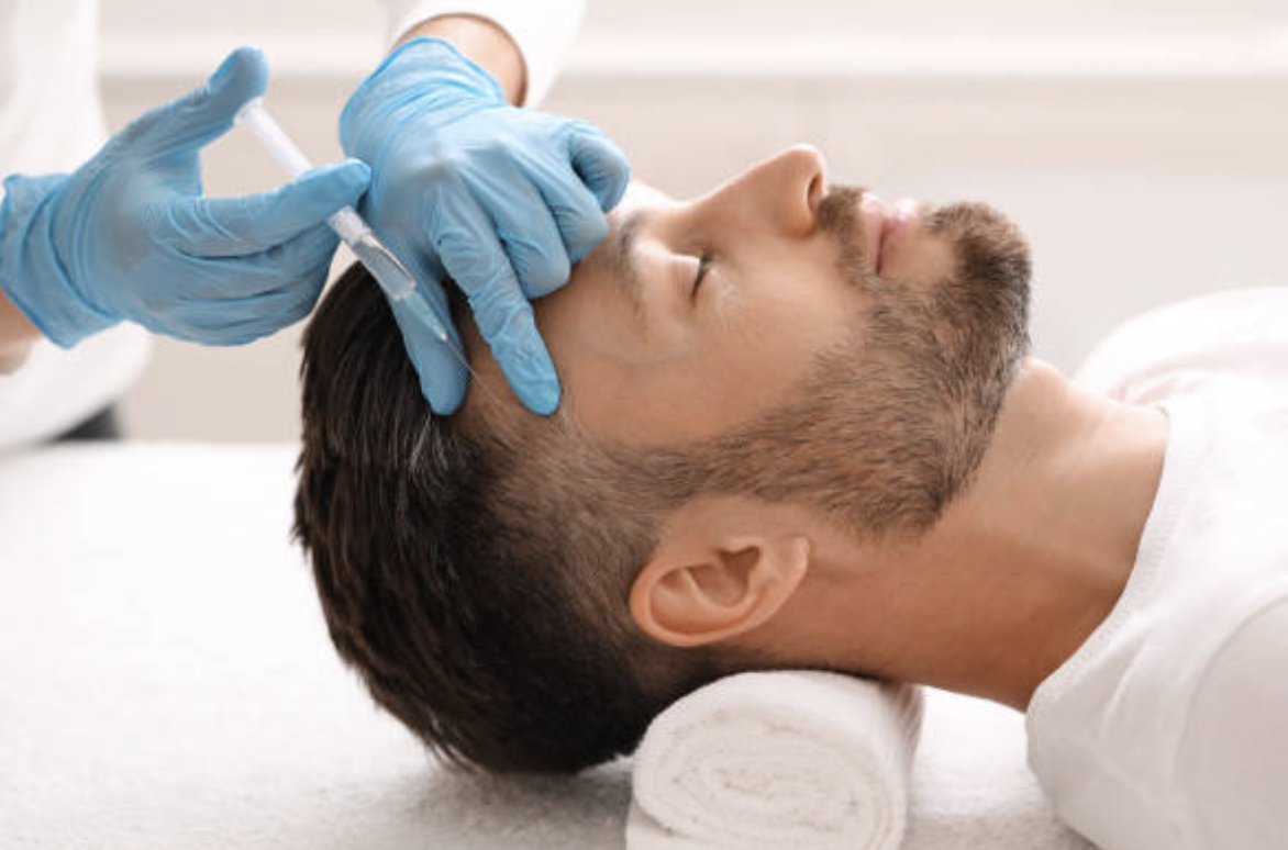 rawatan prp rambut lelaki