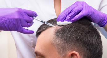 6 KEBAIKAN RAWATAN PRP RAMBUT DI MALAYSIA
