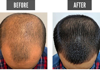 before and after hair