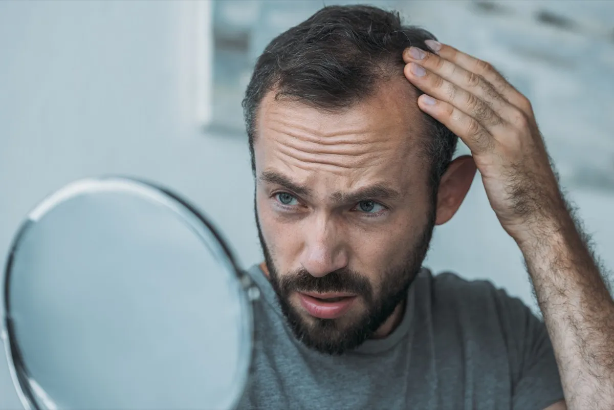 balding man looking into the mirror
