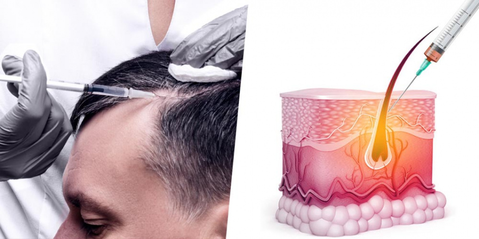 SureGrow-Hair-Transplant-Promo-02